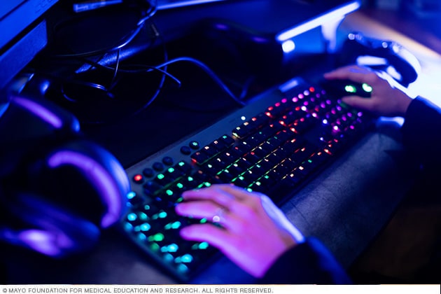 Gaming and Esports Medicine - Overview - Mayo Clinic