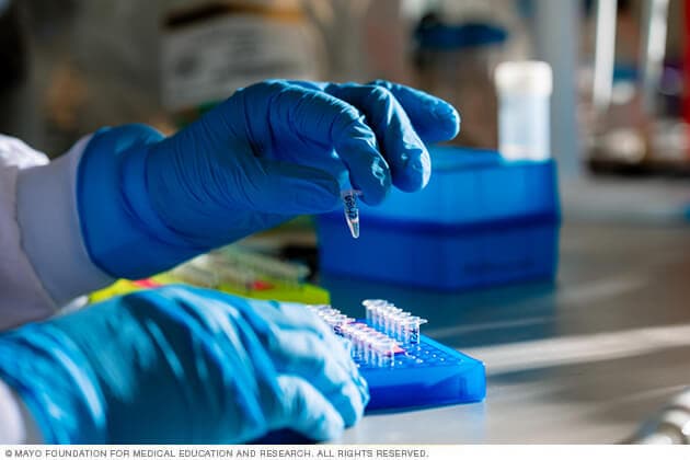 A researcher wearing sterile gloves prepares samples in a laboratory.