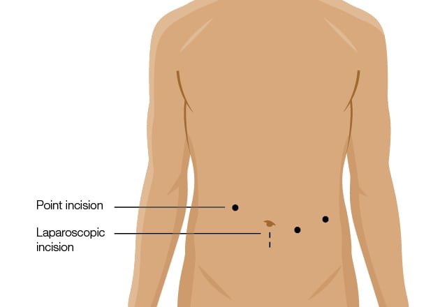 Ø³Ø±Ø·Ø§Ù† Ø§Ù„Ø¨Ù†ÙƒØ±ÙŠØ§Ø³ Ø§Ù„Ø±Ø¹Ø§ÙŠØ© ÙÙŠ Mayo Clinic Mayo Clinic Ù…Ø§ÙŠÙˆ ÙƒÙ„ÙŠÙ†Ùƒ