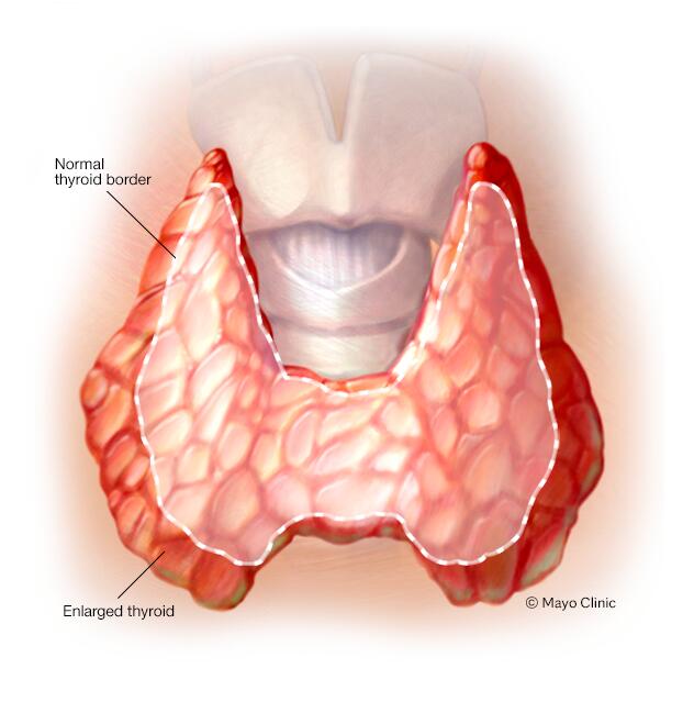 normal thyroid size