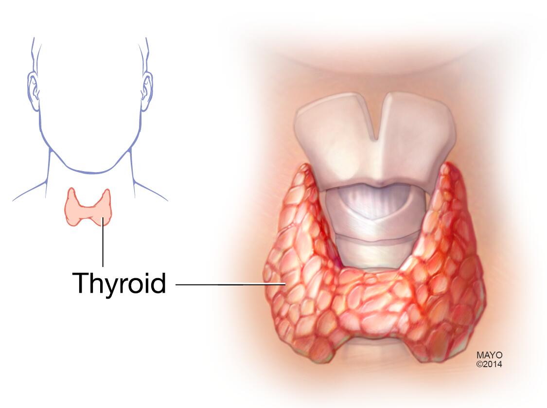 Nódulos tiroideos - Síntomas y causas - Mayo Clinic