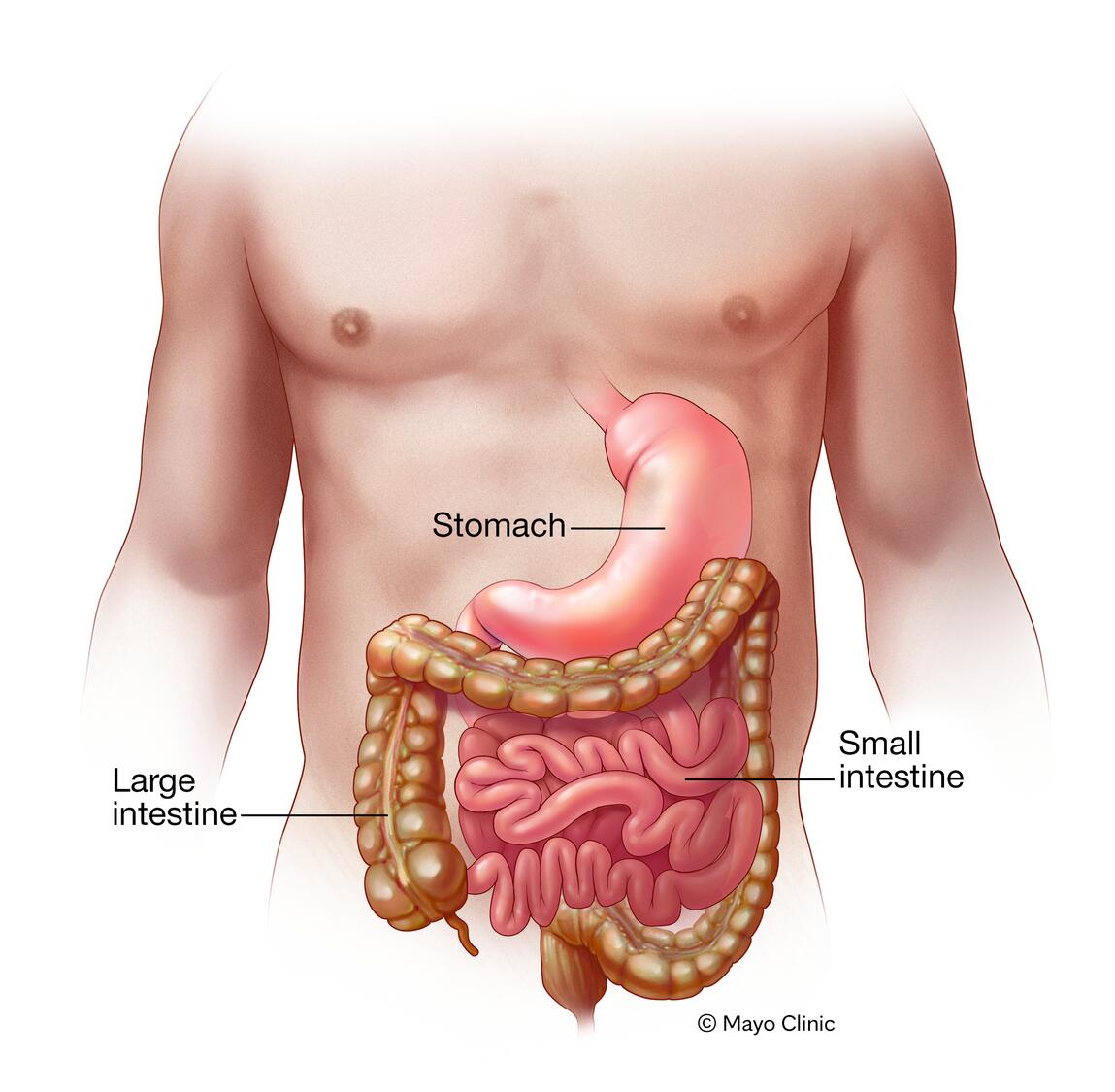 sintomas de gastroenteritis
